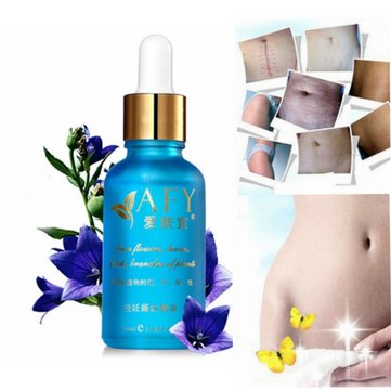 AFY Stretch Obesity Marks Removal Essential Oil Postpartum Recovery